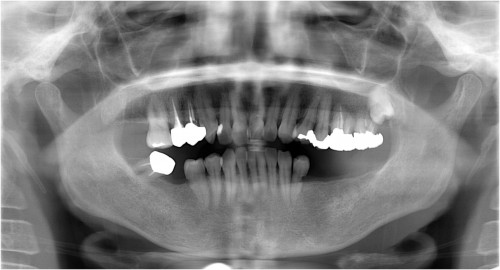 金原１　初診時　◎